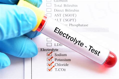 u e blood test bottle|urea and electrolytes interpretation uk.